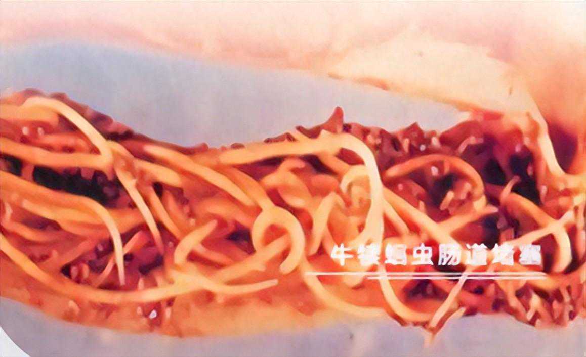 线虫 - 犊牛蛔虫病