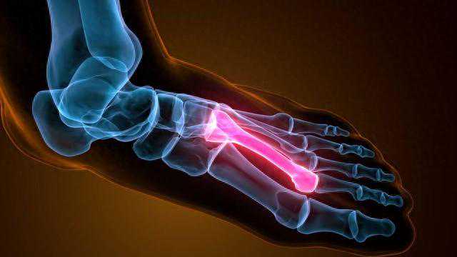 一降温膝盖就痛，是风湿病吗？医生：不一定，可能是其他三种疾病